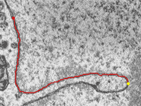 Livewire Image Segmentation Algorithm for SLASH